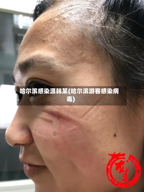 哈尔滨感染源韩某(哈尔滨游客感染病毒)-第2张图片